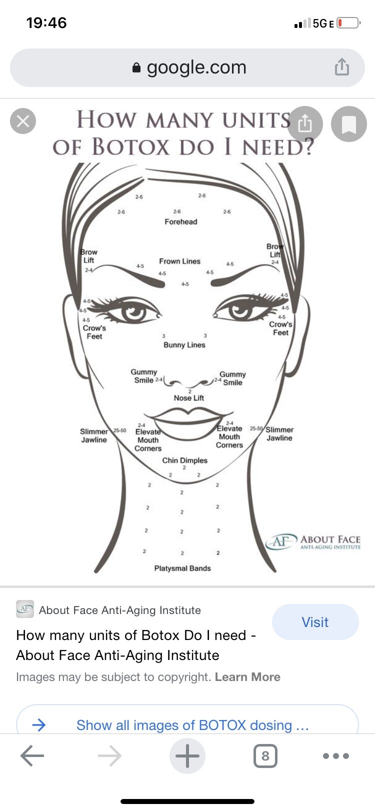 Printable Botox Injection Face Map