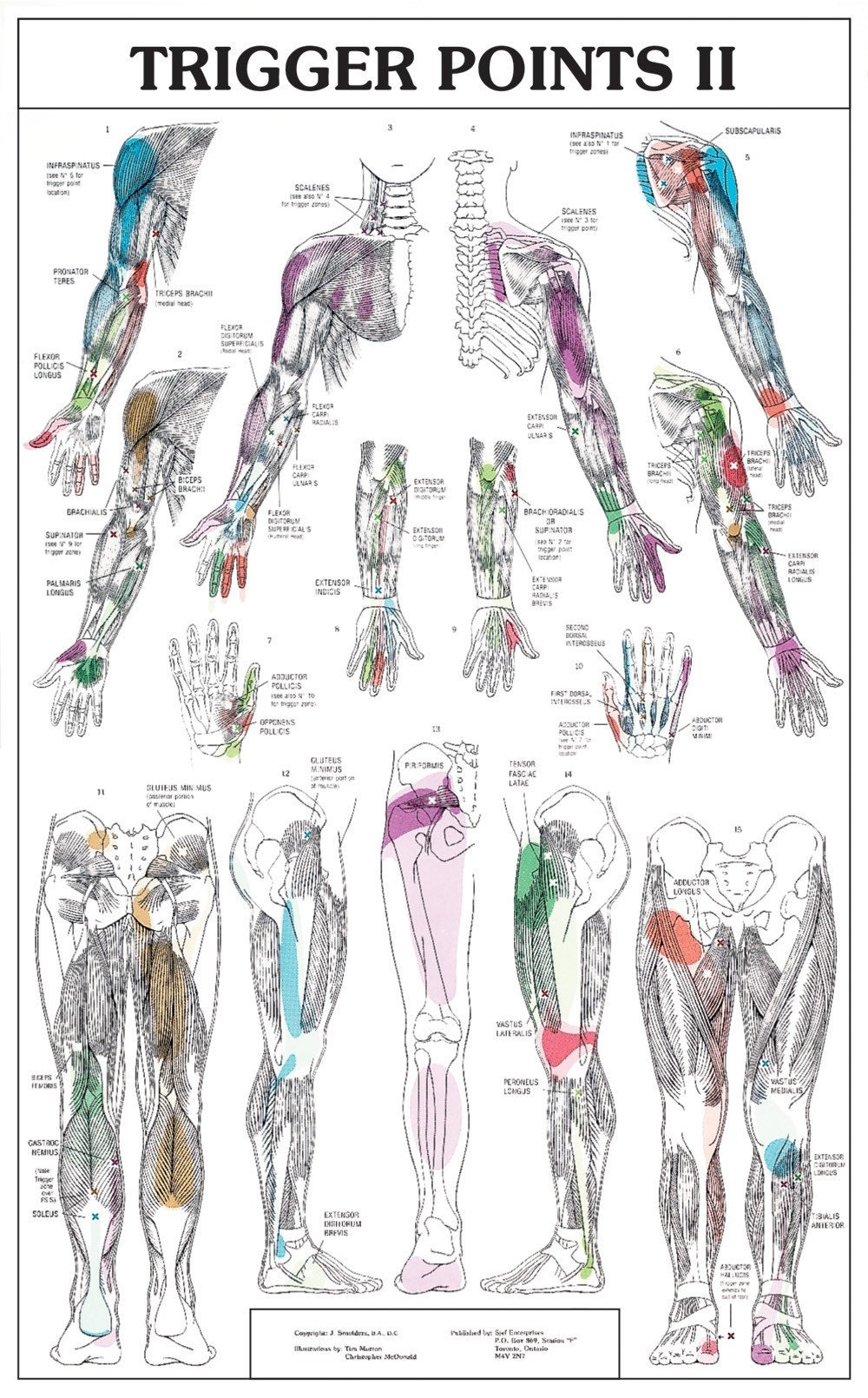 printable trigger points chart