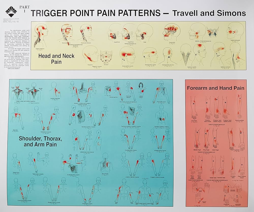 Trigger Points Of Pain Wall Charts Set Of 2 9780683083682 Medicine Health Science Books Amazon